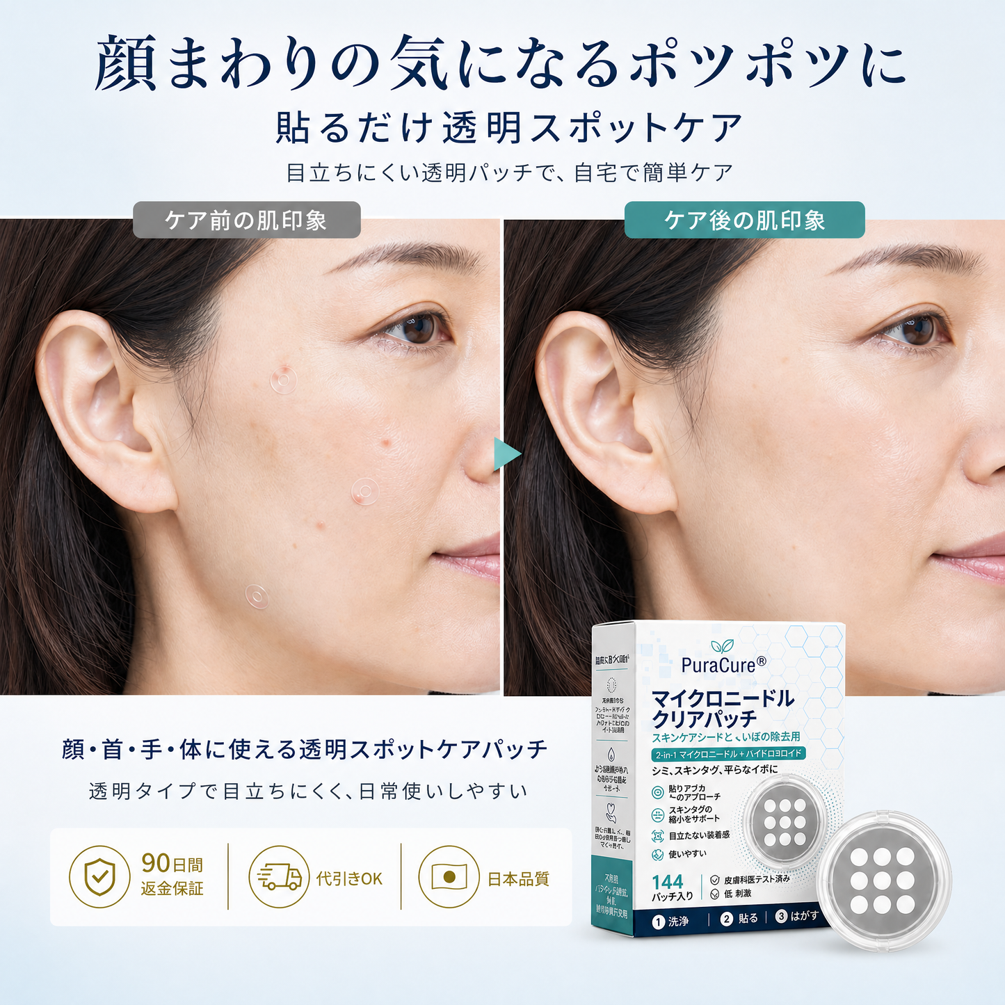 🌼PuraCure® 2-in-1 マイクロニードル＆ハイドロコロイドパッチ🍀| 盛り上がったホクロ・ニキビ・扁平イボ・スキンタッグのケアに | シワ・ニキビ跡・肌の色ムラをケア | 目立たない透明パッチ（顔・体用）