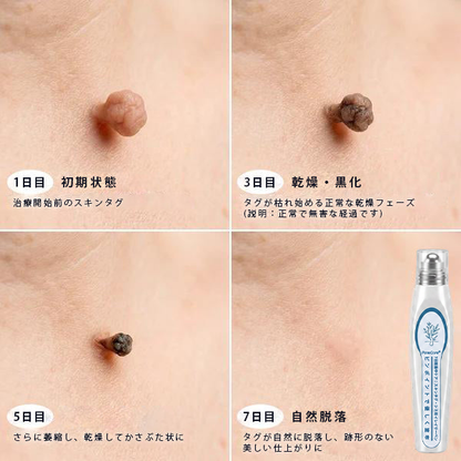 💧💧💧公式ストア🎉PuraCure® 7日間スポット＆シミ除去ケア （ゼロ痛み・ゼロダメージ ローラーボール）
